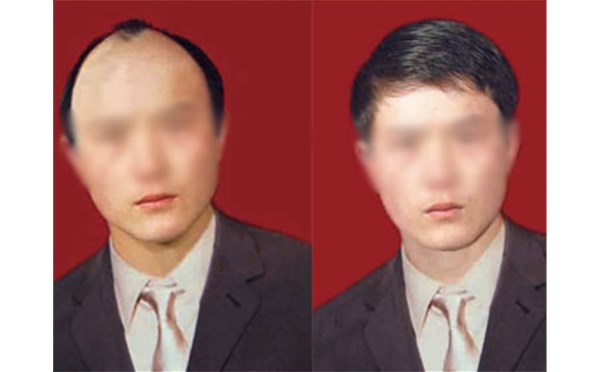 为什么要选择织发补发？