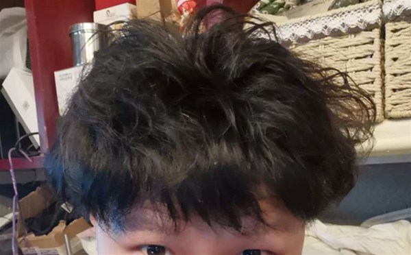 男士戴假发要怎么戴更好看？南阳顶美教你一招秒变型男