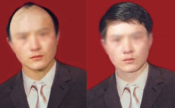 南阳假发块和全头套哪个更好？